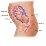 gravid 28